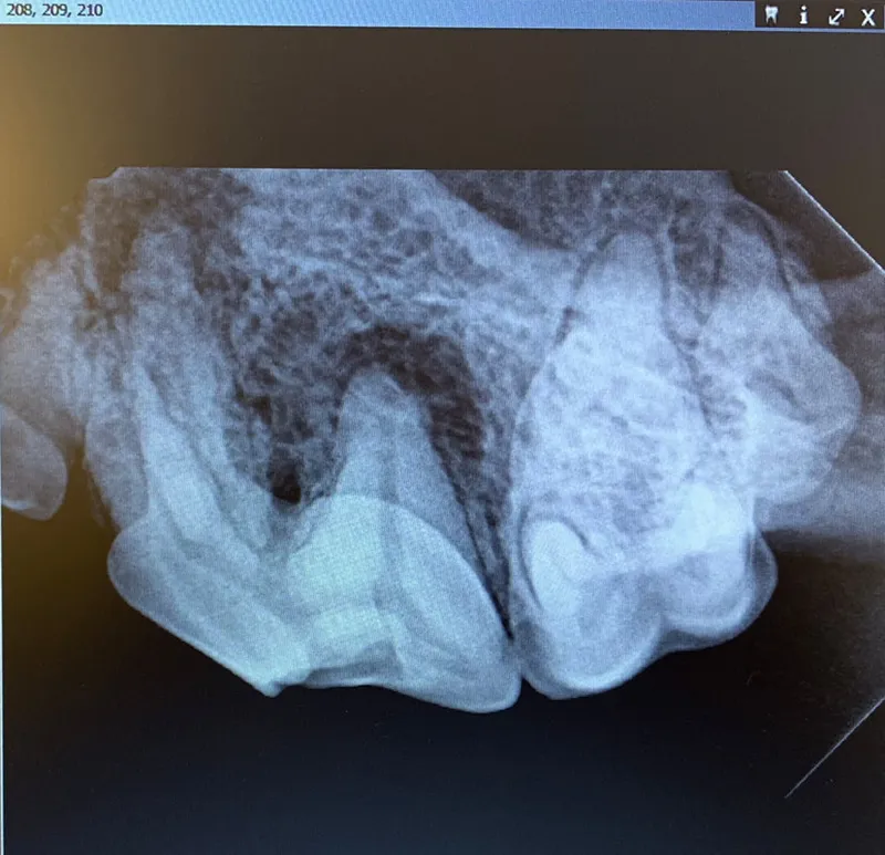 X-Ray of a dog's tooth